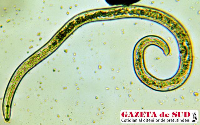 Nematodele ar putea deţine secretul vindecării unor boli