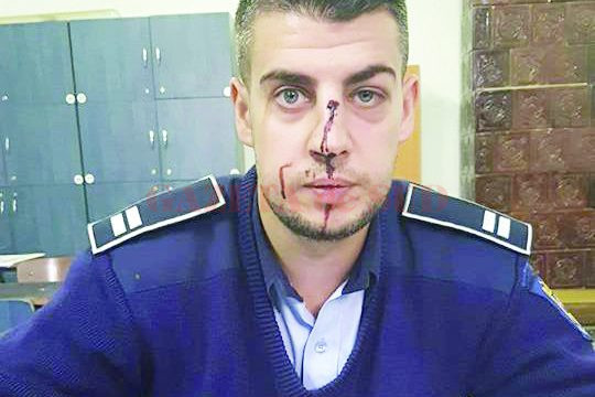 Sindicatul Polițiștilor Dolj a făcut publică, joi, o fotografie a agentului lovit de tânărul din Balș