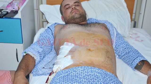 Unul dintre tinerii înjunghiați în urma scandalului din Argetoaia a fost internat la Secția de Chirurgie a Spitalului de Urgență Craiova (FOTO: Claudiu Tudor)