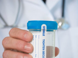 Un nou test de urină pentru depistarea cancerului de prostată