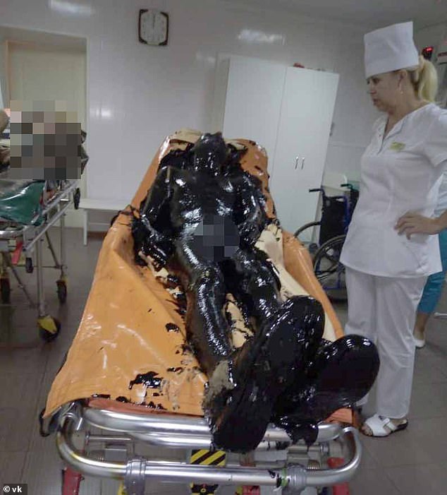 Omul așezat pe un pat de spital după operația de curățare a substanței toxice de pe piele