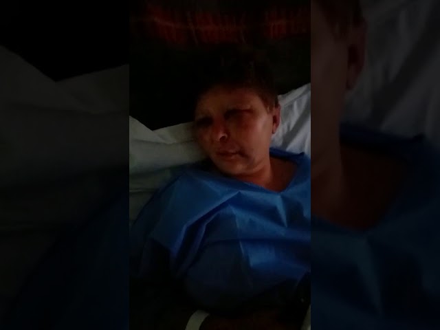 VIDEO / Mărturii uluitoare de pe patul de spital ale femeii agresate de poliţistul din Olt