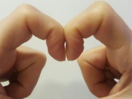 Detaliul banal al unghiilor poate fi un semn al cancerului la plămâni