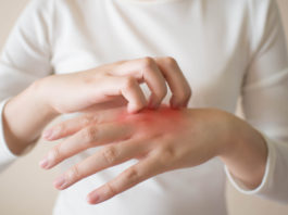 Ce sunt eczemele şi cum le tratăm