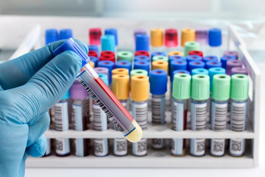 Au fost reluate tratamentele fără interferon pentru pacienții cu hepatita virală cronică C