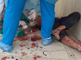 Un individ plin de sânge, fugit din autoizolare, a intrat în Spitalul Hârșova, unde a început să scuipe, să amenințe și să jignească personalul medical