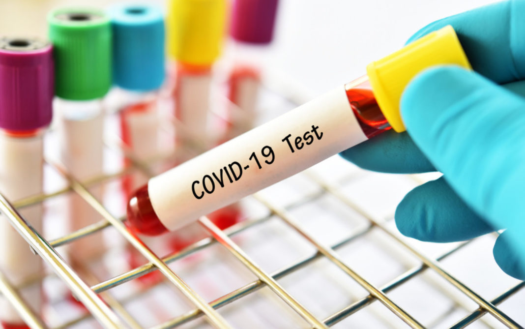 Din 90 probe analizate aleatoriu de specialiștii MedLife, 45 conțineau tulpina de coronavirus originară din Marea Britanie
