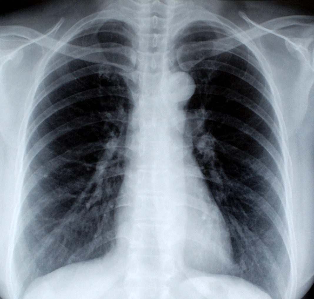 radiografie