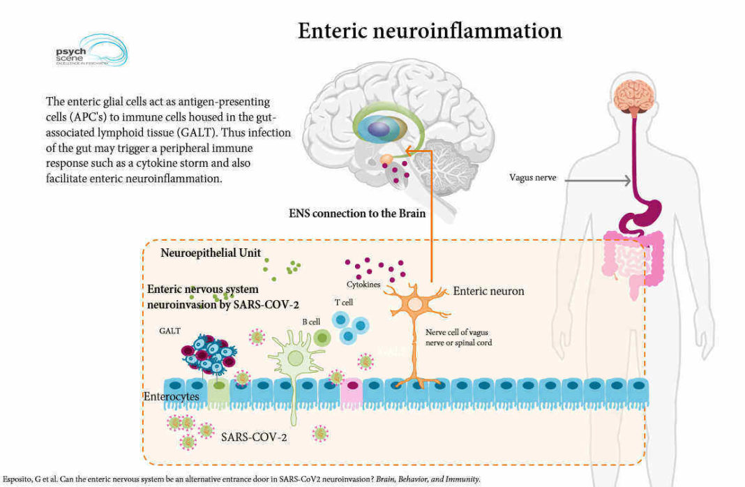 Oamenii de ştiinţă avertizează asupra unui potenţial val de leziuni cerebrale asociate COVID-19