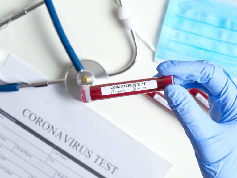 Gorj: Un deces și 9 cazuri noi de coronavirus