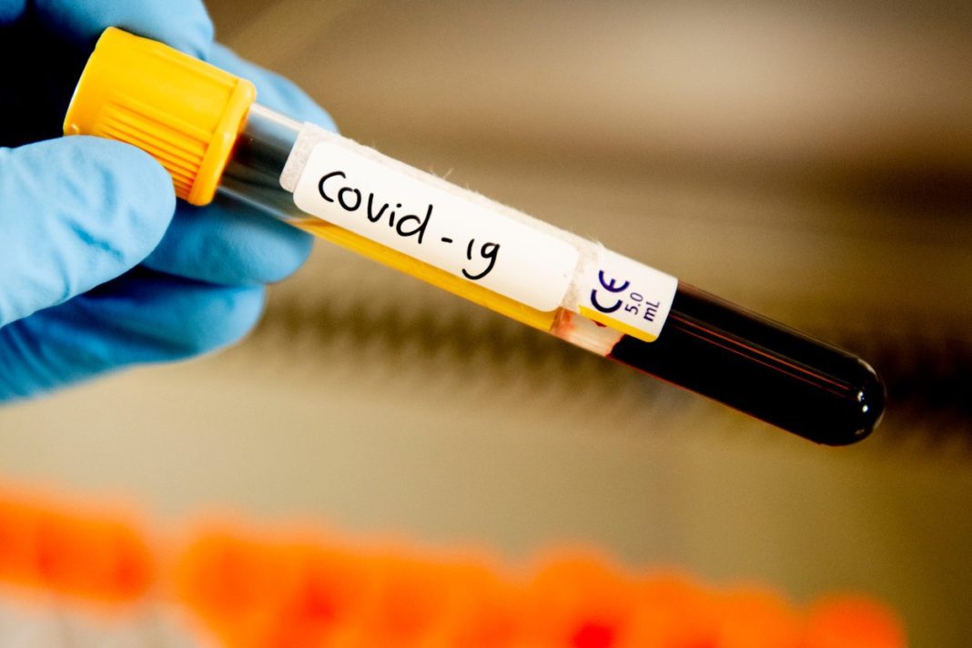 Direcția de Sănătate Publică (DSP) Gorj a înregistrat încă șase cazuri noi de coronavirus