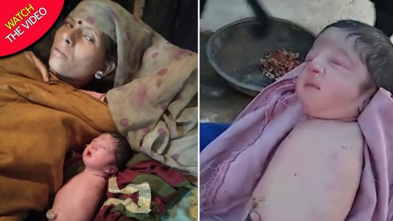 O fetiță s-a născut fără mâini și picioare