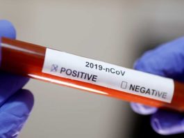 În ultimele 24 de ore au fost internate în spitalele din Vâlcea opt persoane confirmate pozitiv cu virusul SARS-COV-2