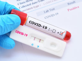 Au fost înregistrate 1.470 de cazuri noi de persoane infectate cu COVID-19