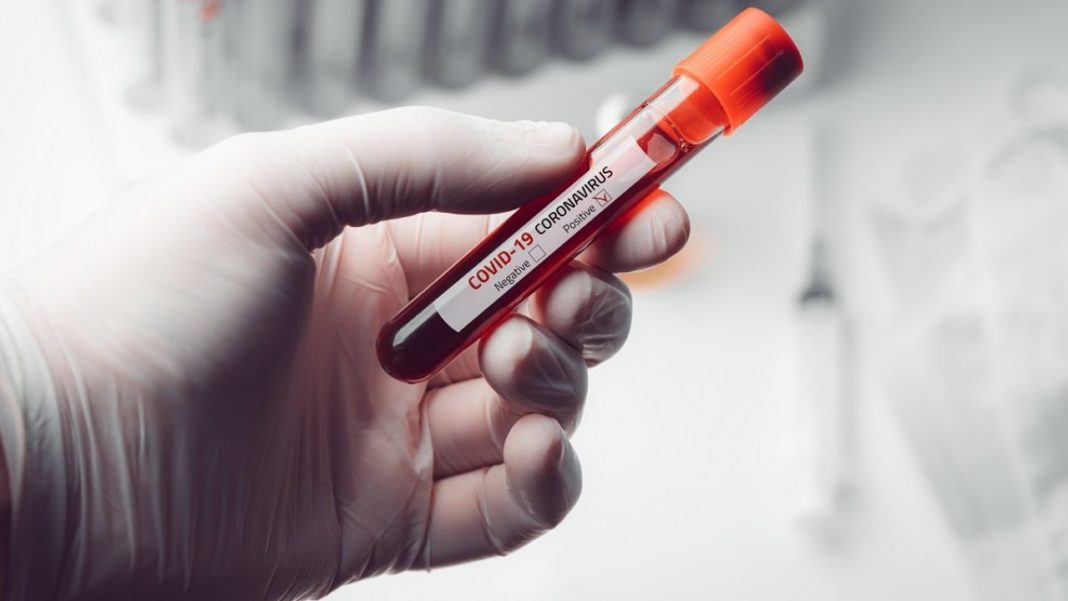 Germania a înregistrat cel mai mare număr de cazuri de COVID-19 după luna mai