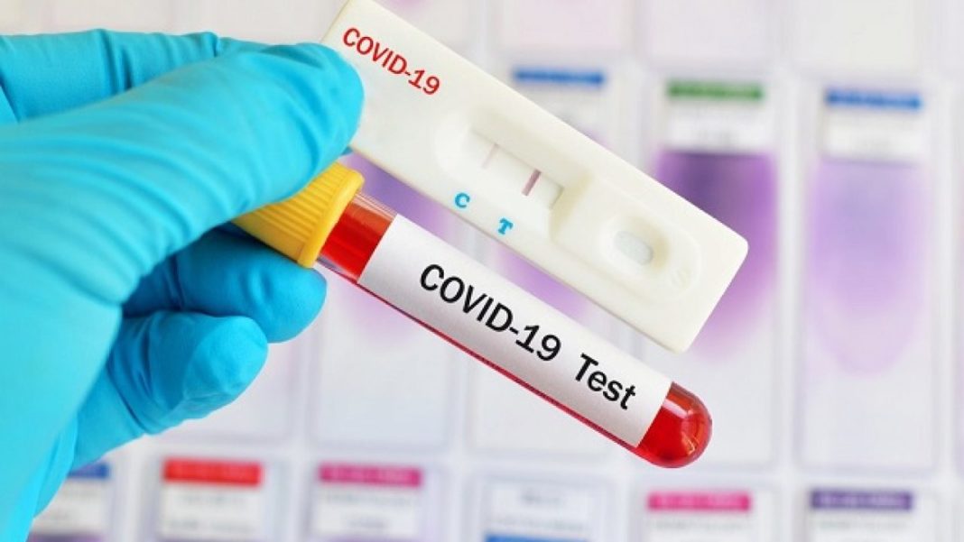 OMS recomandă testarea persoanelor care au intrat în contact cu bolnavi COVID, chiar dacă nu au simptome