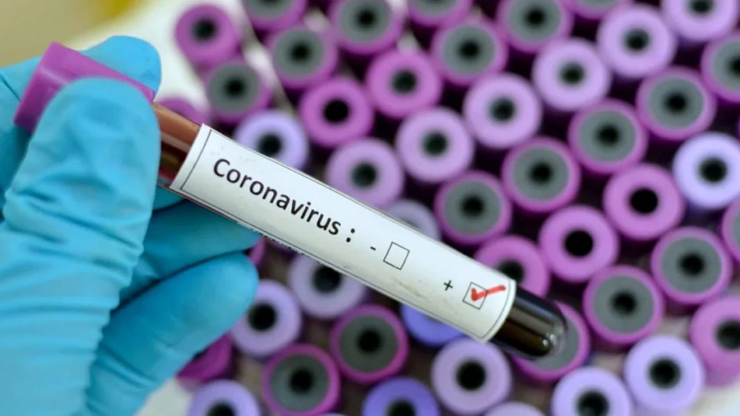Coronavirus în România. Numărul cazurilor confirmate a crescut cu 3.034, până la 640.429, potrivit datelor furnizare duminică de GCS.