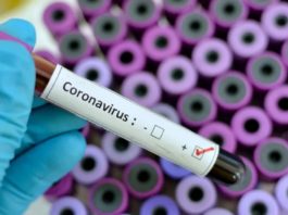 Coronavirus în România. Numărul cazurilor confirmate a crescut cu 3.034, până la 640.429, potrivit datelor furnizare duminică de GCS.