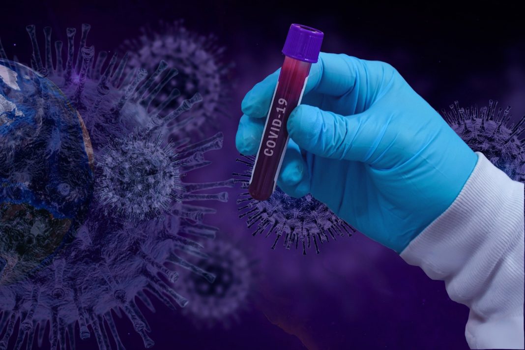 Coronavirus în lume: Bilanțul cazurilor a trecut de 27 de milioane de infectări. Decesele au ajuns la cifra de 883.000.