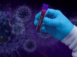 Coronavirus în lume: Bilanțul cazurilor a trecut de 27 de milioane de infectări. Decesele au ajuns la cifra de 883.000.