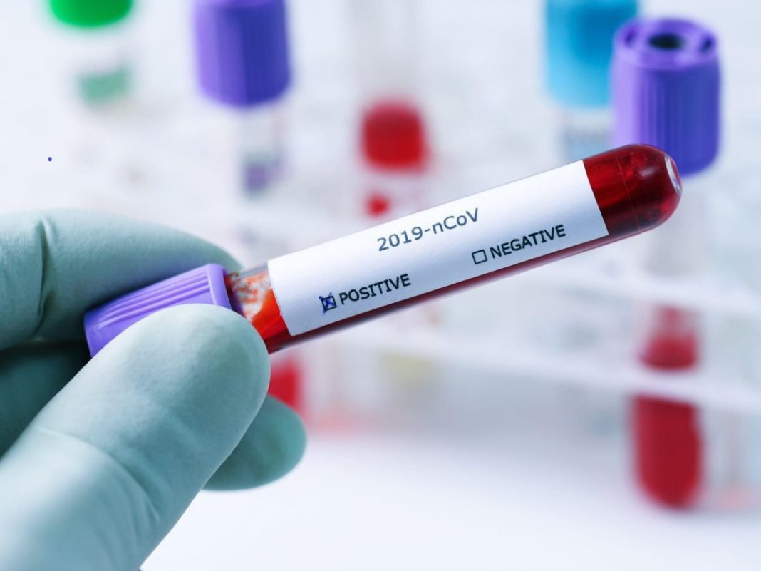 Un test care detectează și diferențiază SARS-CoV-2 de virusurile gripale A şi B, aprobat în procedură de urgență