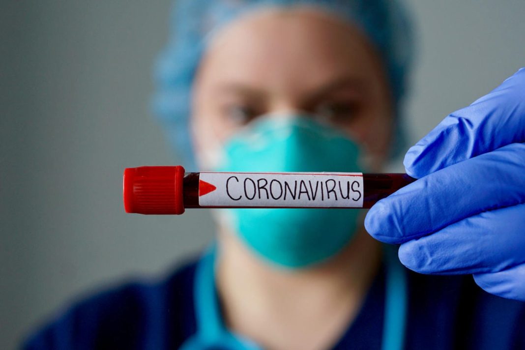 Au fost înregistrate 3.400 cazuri noi de persoane infectate cu SARS – CoV - 2 (COVID – 19), acestea fiind cazuri care nu au mai avut anterior un test pozitiv