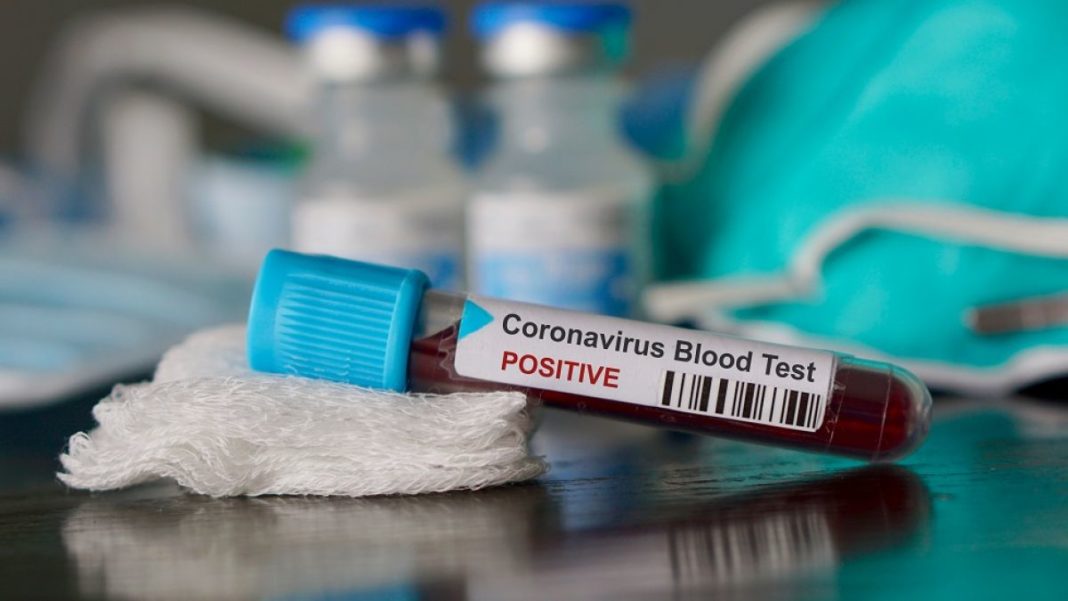 Gorj: Femeie, de 37 de ani, moartă de coronavirus