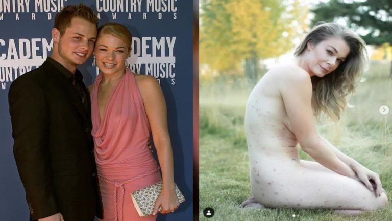 Leann Rimes, fotografiată complet dezbrăcată pe o pajiște, pentru a atrage atenția asupra psoriazisului