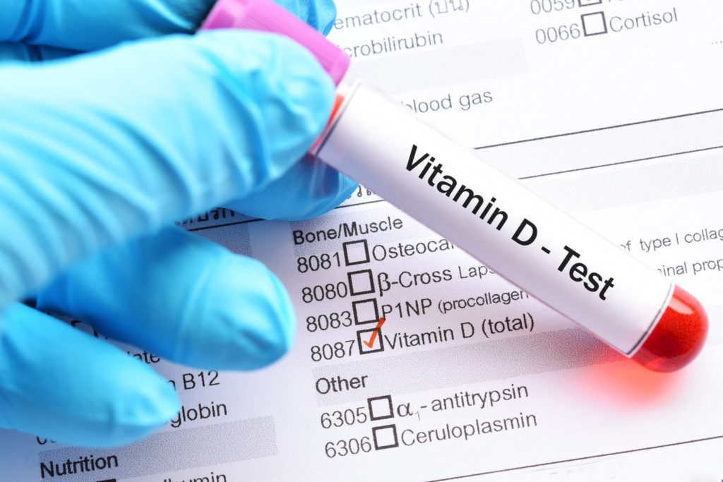 Britanicii vor să introducă vitamina D în alimentele de bază
