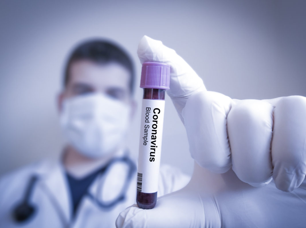 Au fost înregistrate 4.272 cazuri noi de persoane infectate cu COVID-19