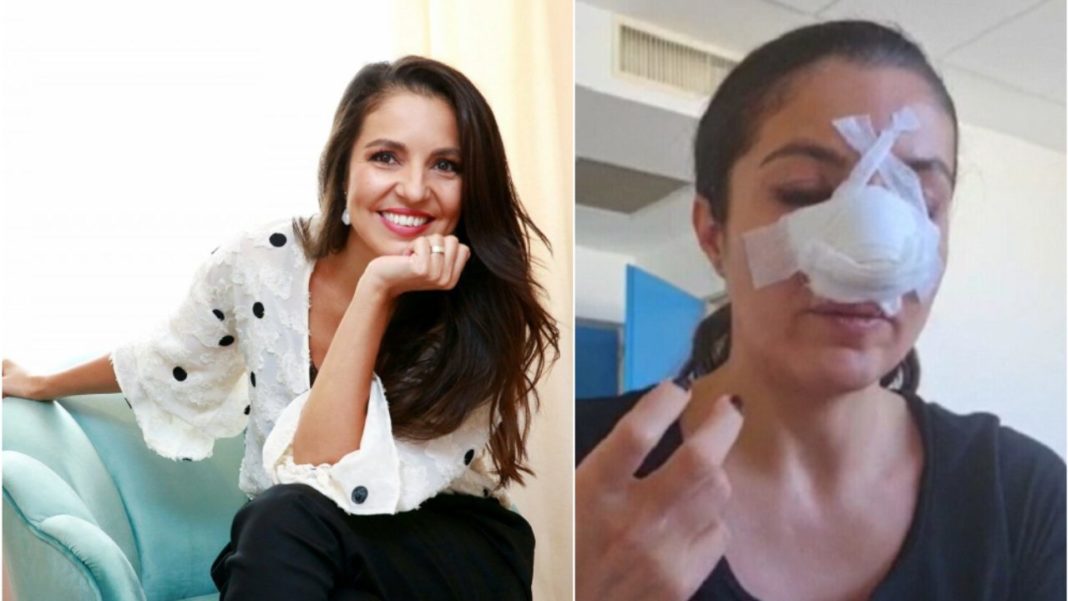 Femeia care ar fi lovit-o în faţă pe Cristina Joia, reţinută de poliţişti