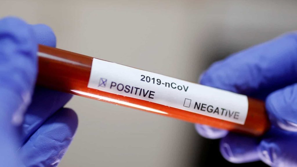 Coronavirus/Alte 2.049 de cazuri noi în România
