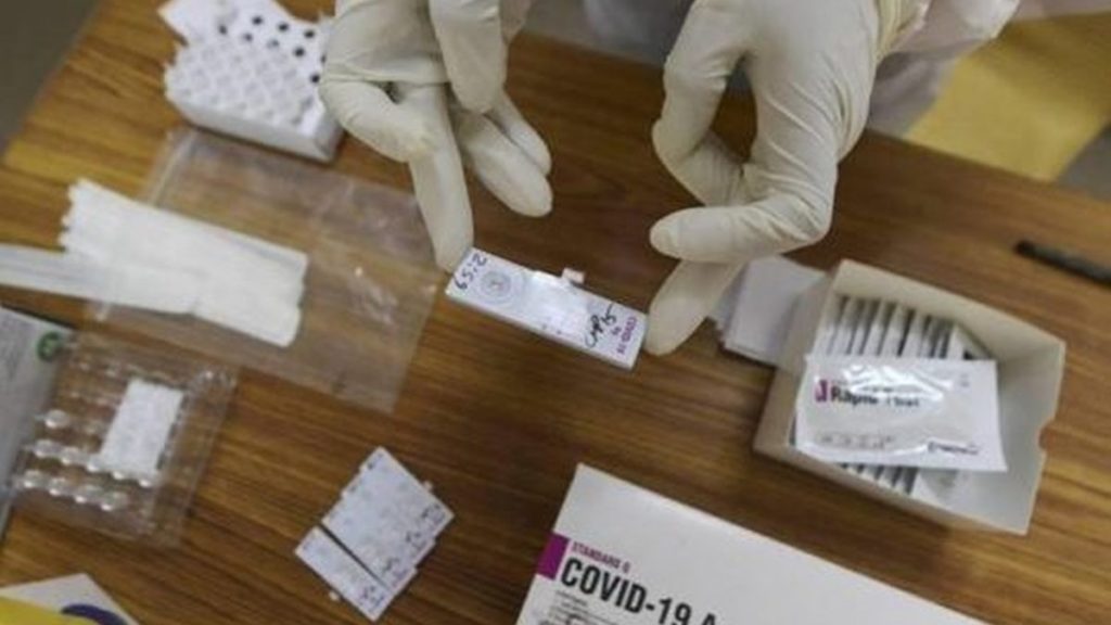 Comisia Europeană: Testele rapide pentru COVID să fie folosite la nivelul întregii populații