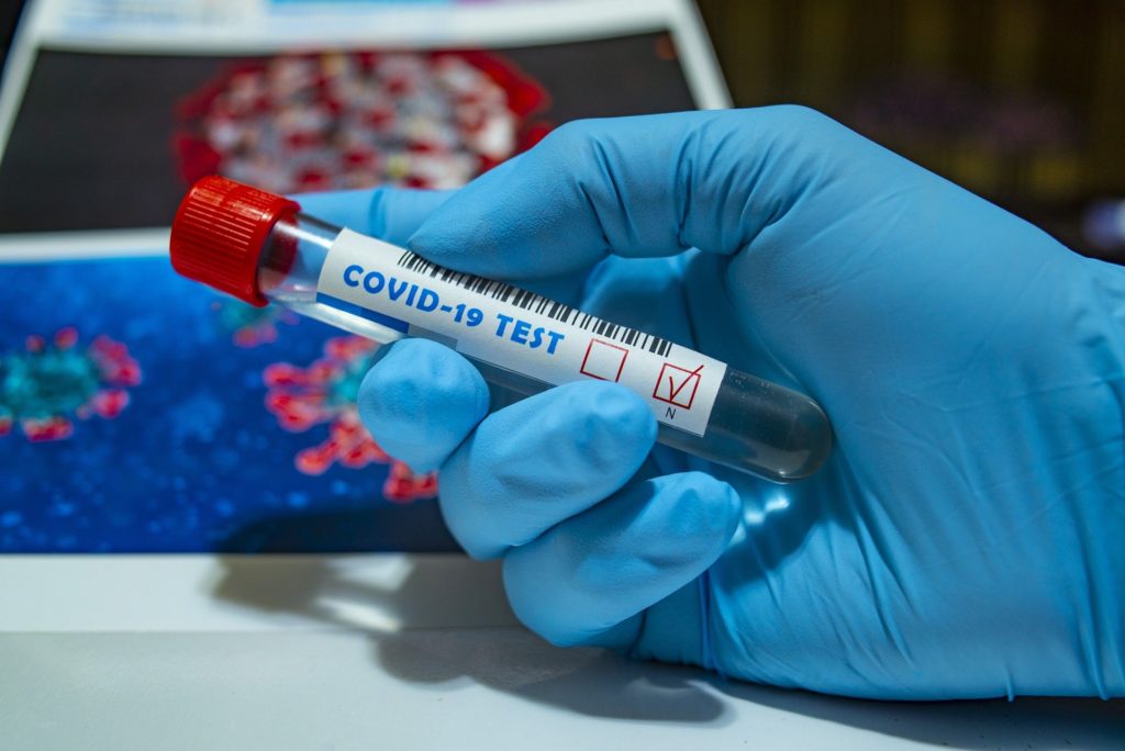 19 cazuri noi de coronavirus în județul Gorj