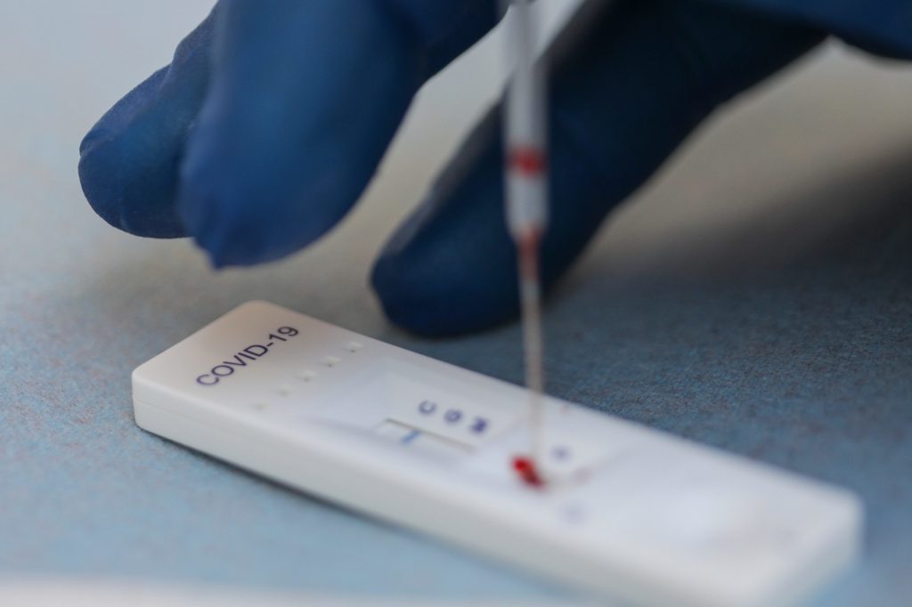 România: 33.922 de teste, efectuate în ultimele 24 de ore