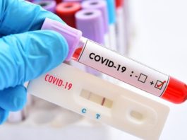 Comisia Europeană recomandă testare RT-PCR la frontiere