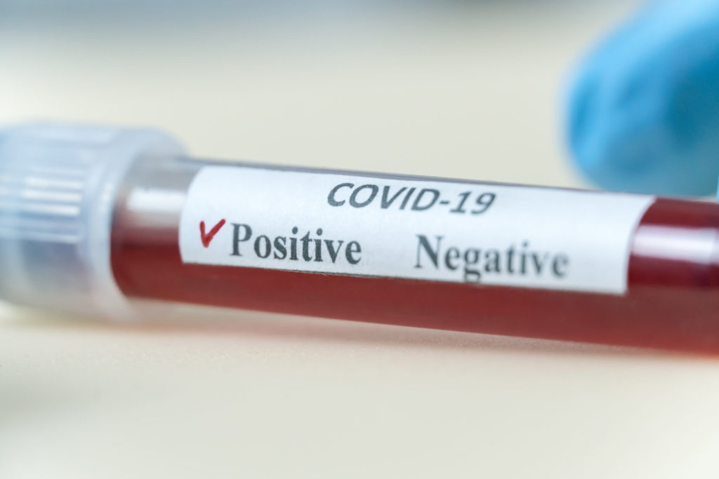 Încă 30 de cazuri noi de coronavirus în județul Gorj