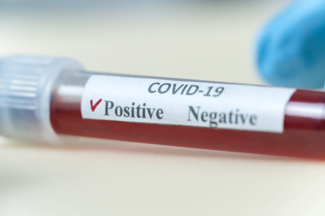 Un singur caz de coronavirus în județul Gorj