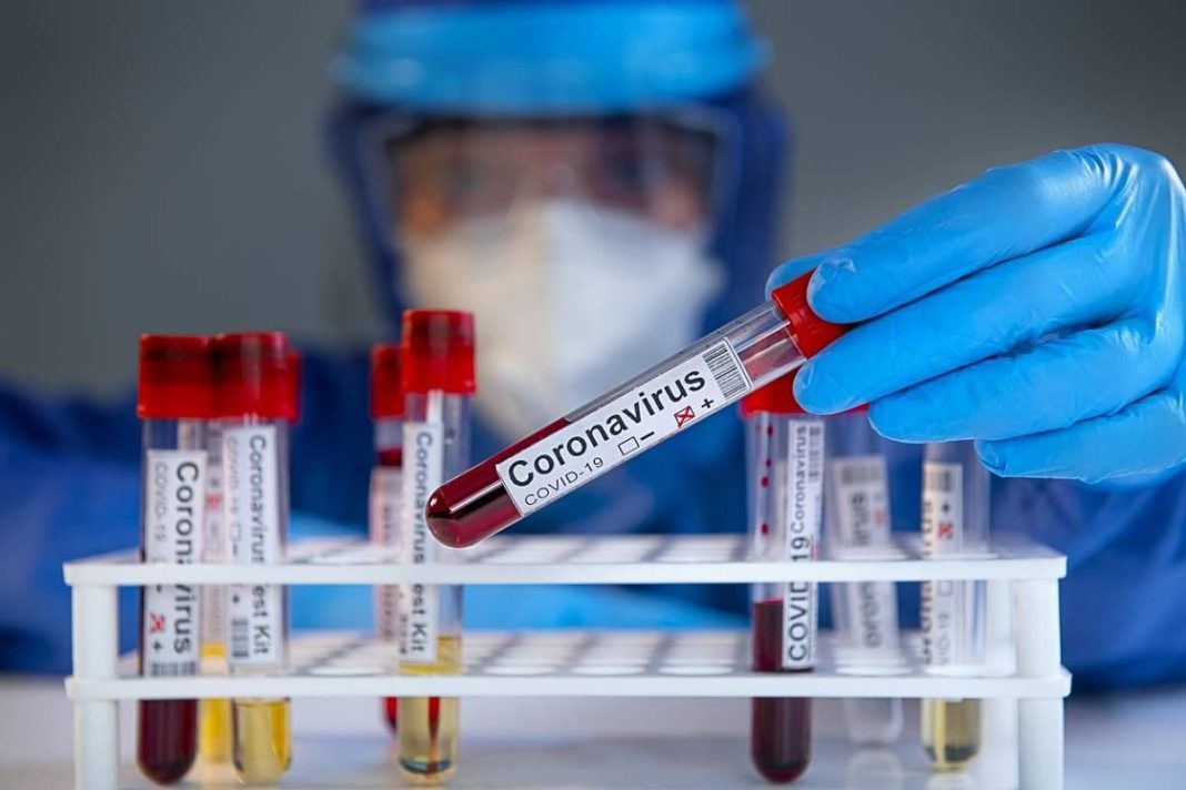 Încă trei decese din cauza coronavirusului în județul Gorj
