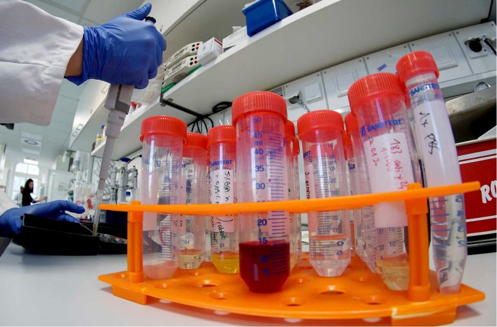 Doi gorjeni, infectați cu tulpina britanică a SARS-CoV-2