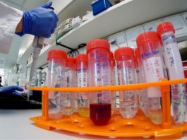 Gorj: Încă cinci decese din cauza coronavirusului și 78 de cazuri noi