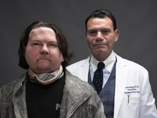 Moment istoric. Primul transplant simultan de mâini şi faţă a fost un succes