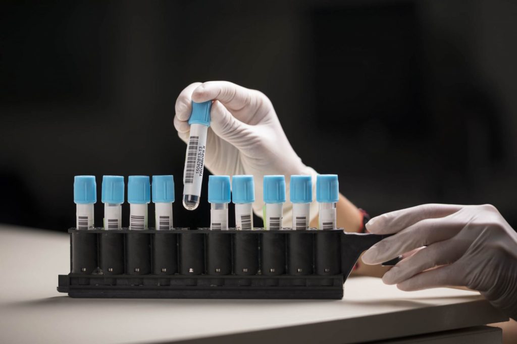 Tulpina britanică a substituit celelalte tulpini care circulau pe teritoriul României