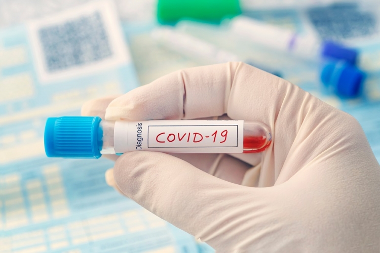 Cum se va face testarea pentru COVID-19 în farmacii