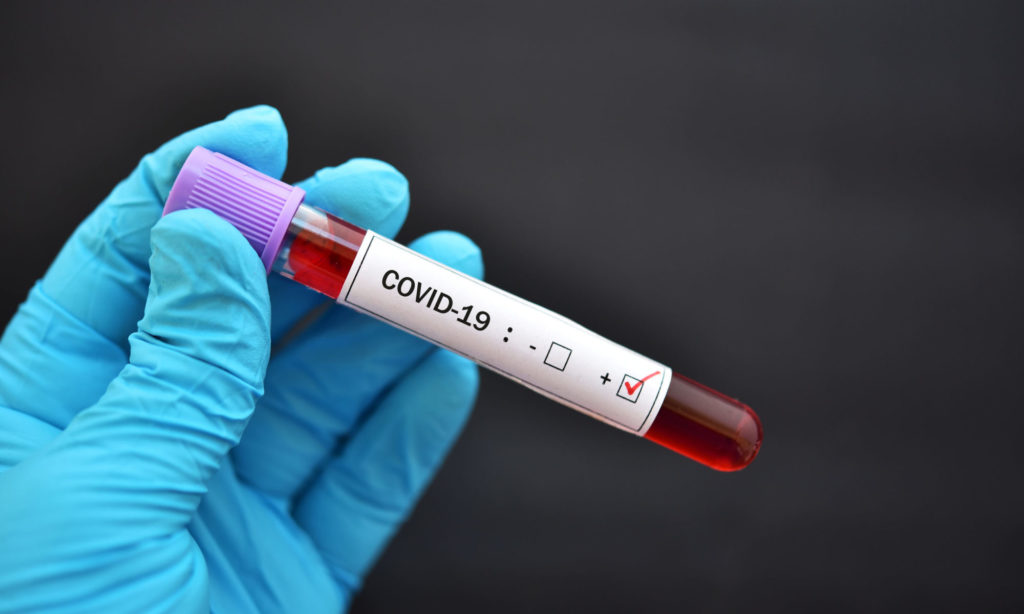 Doar 3 cazuri noi de coronavirus în Gorj