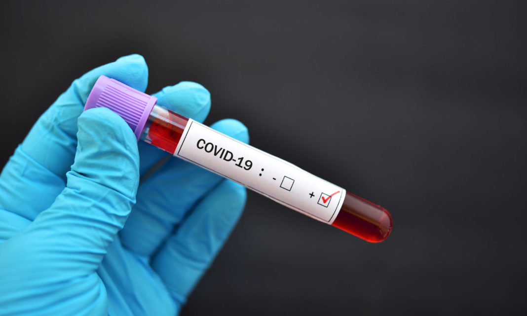 Asistentă de 34 de ani gravidă în luna a 8-a a murit infectată cu COVID
