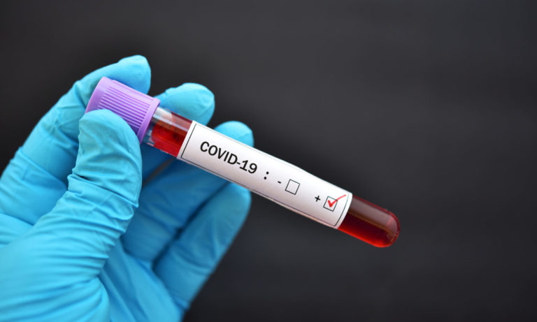 Doar 3 cazuri noi de coronavirus în Gorj