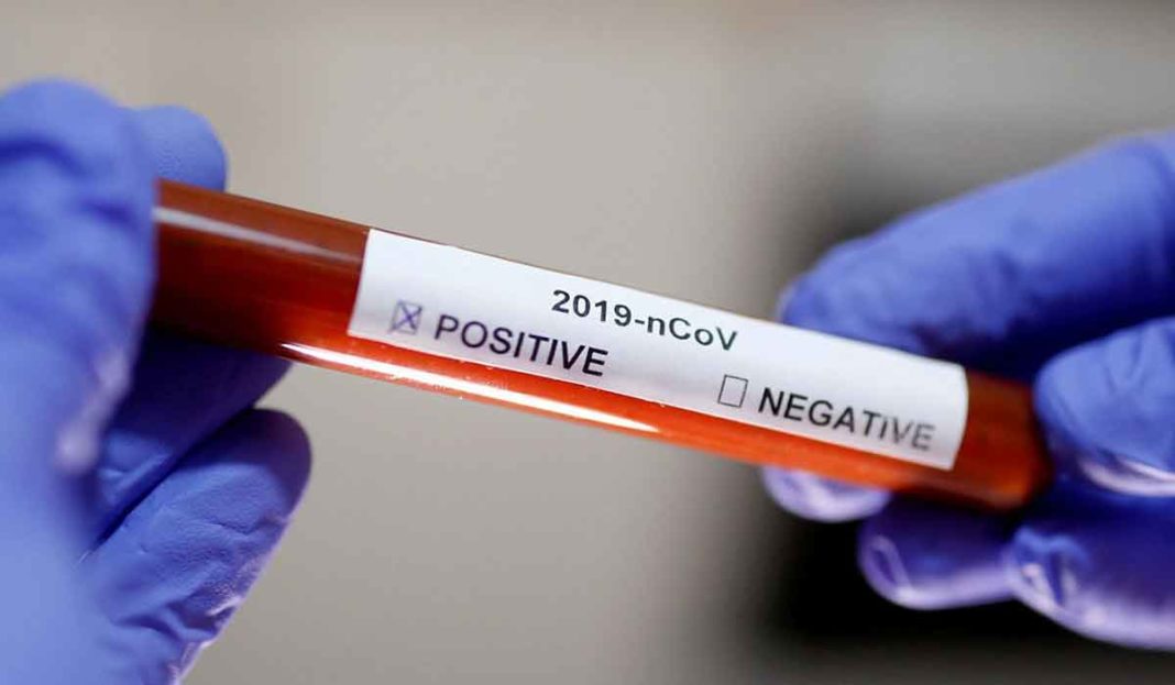 Au fost înregistrate alte 28 de persoane nou confirmate cu virusul SARS-CoV-2