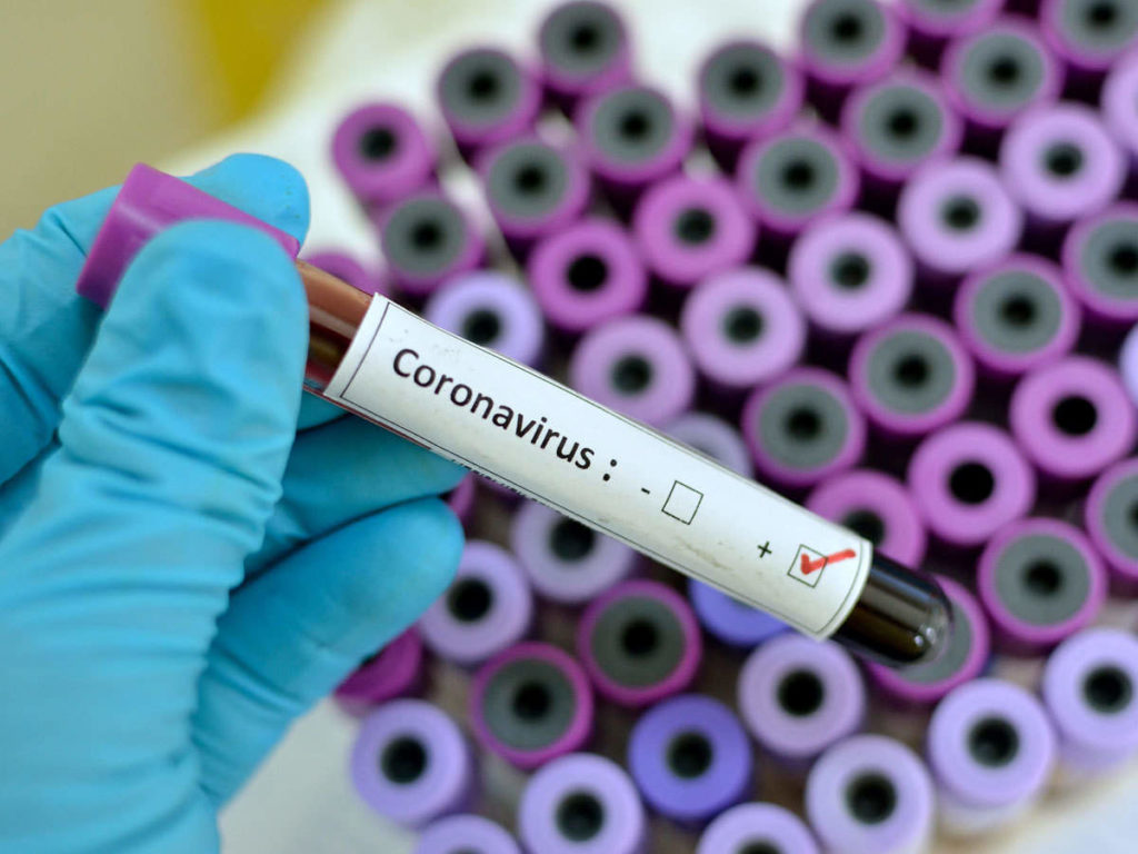 Coronavirus în România: Peste 3.400 de cazuri, după 35.669 de teste