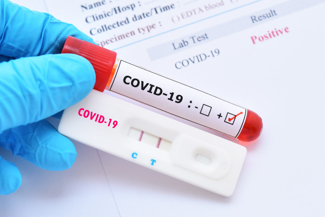 Au fost înregistrate 699 de cazuri noi de persoane infectate cu COVID-19, acestea fiind cazuri care nu au mai avut anterior un test pozitiv